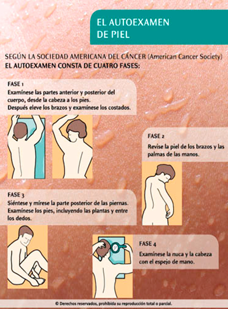 Autoexamen de Piel - Cáncer de Piel